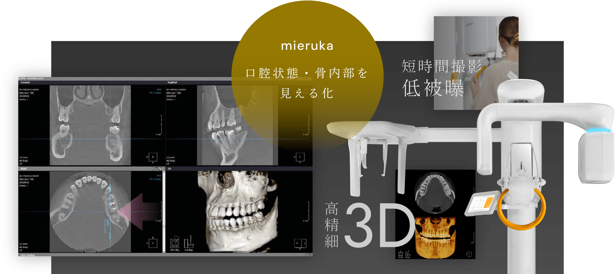 口腔状態・骨内部を見える化／短時間撮影 低被曝／高精細3D