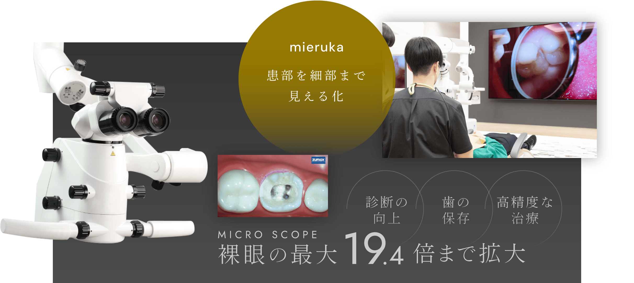 患部を細部まで見える化／裸眼の最大19.4倍まで拡大 診断の向上・歯の保存・高精度な治療