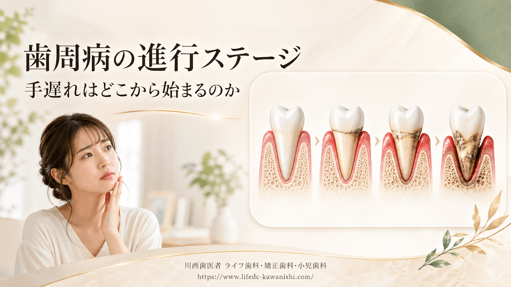 歯周病の進行ステージ:手遅れはどこから始まるのか