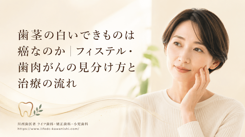 歯茎の白いできものは癌なのか|フィステル・歯肉がんの見分け方と治療の流れ