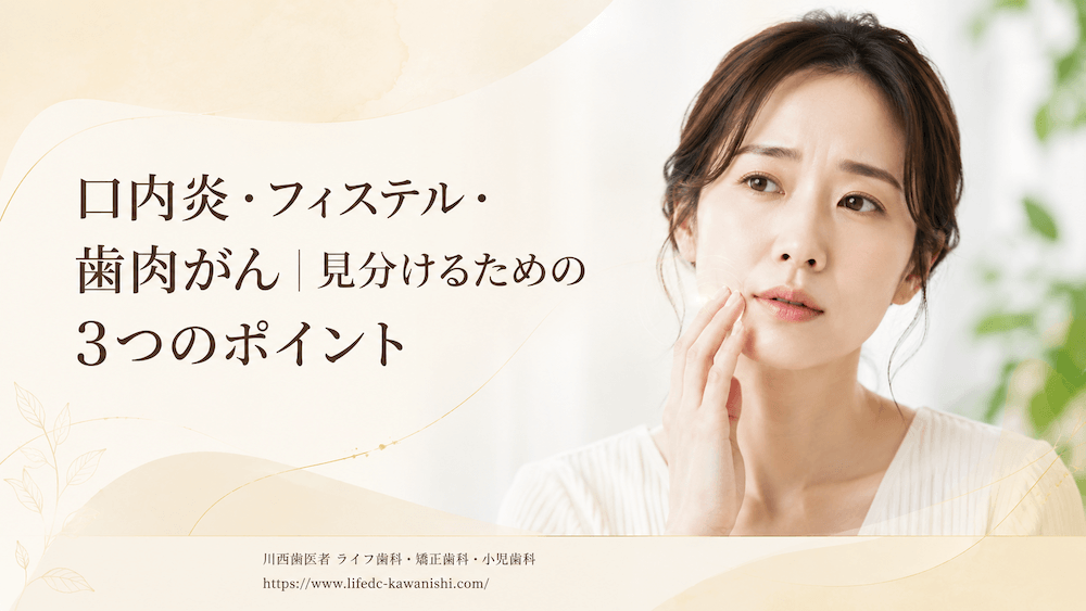 口内炎・フィステル・歯肉がん|見分けるための3つのポイント