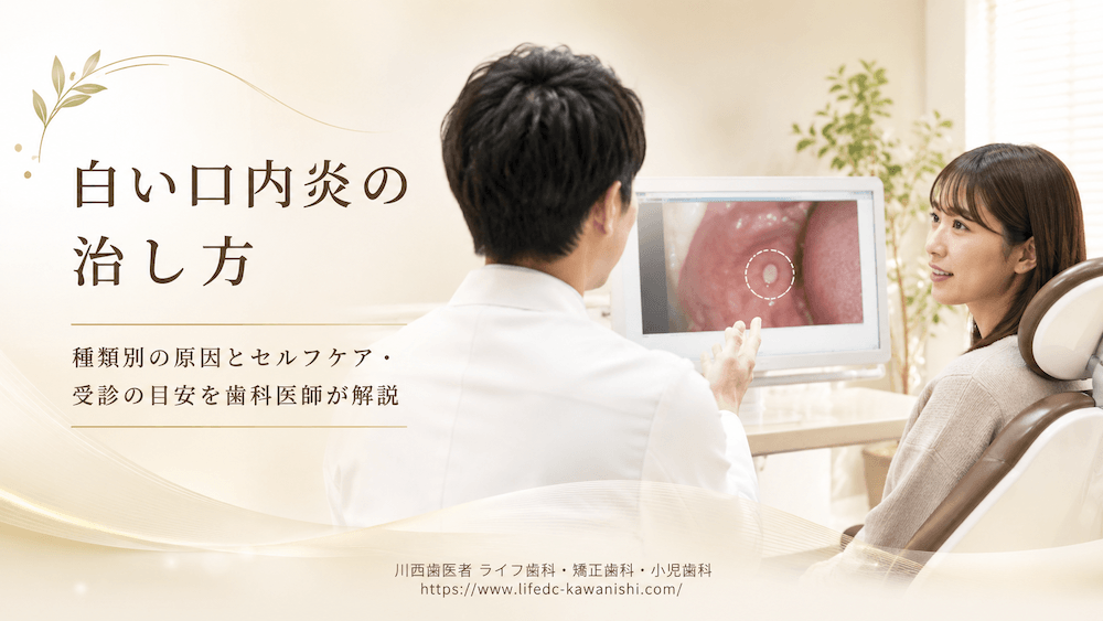 白い口内炎の治し方|種類別の原因とセルフケア・受診の目安を歯科医師が解説