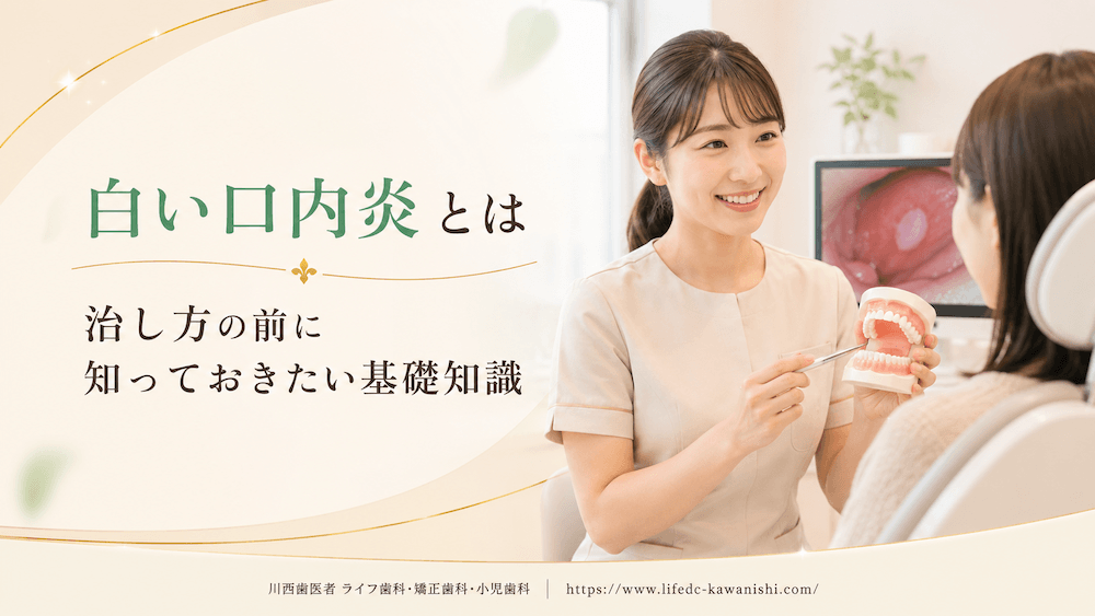 白い口内炎の治し方|種類別の原因とセルフケア・受診の目安を歯科医師が解説