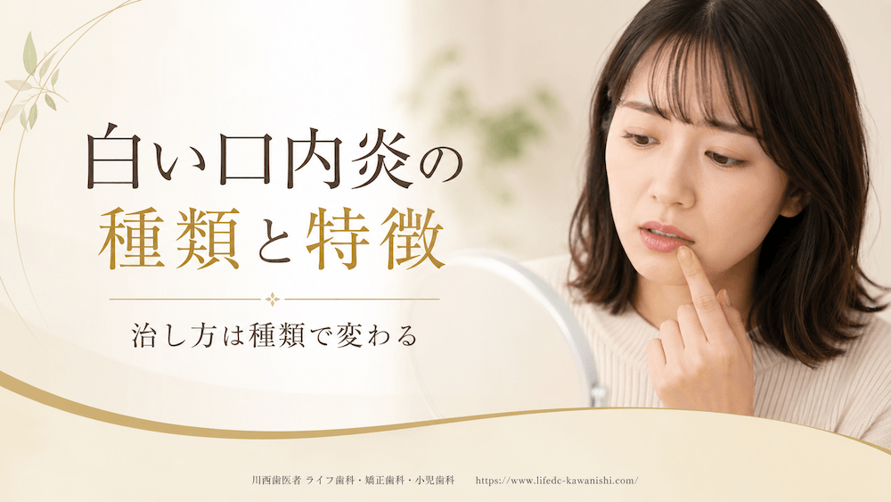 白い口内炎の種類と特徴|治し方は種類で変わる