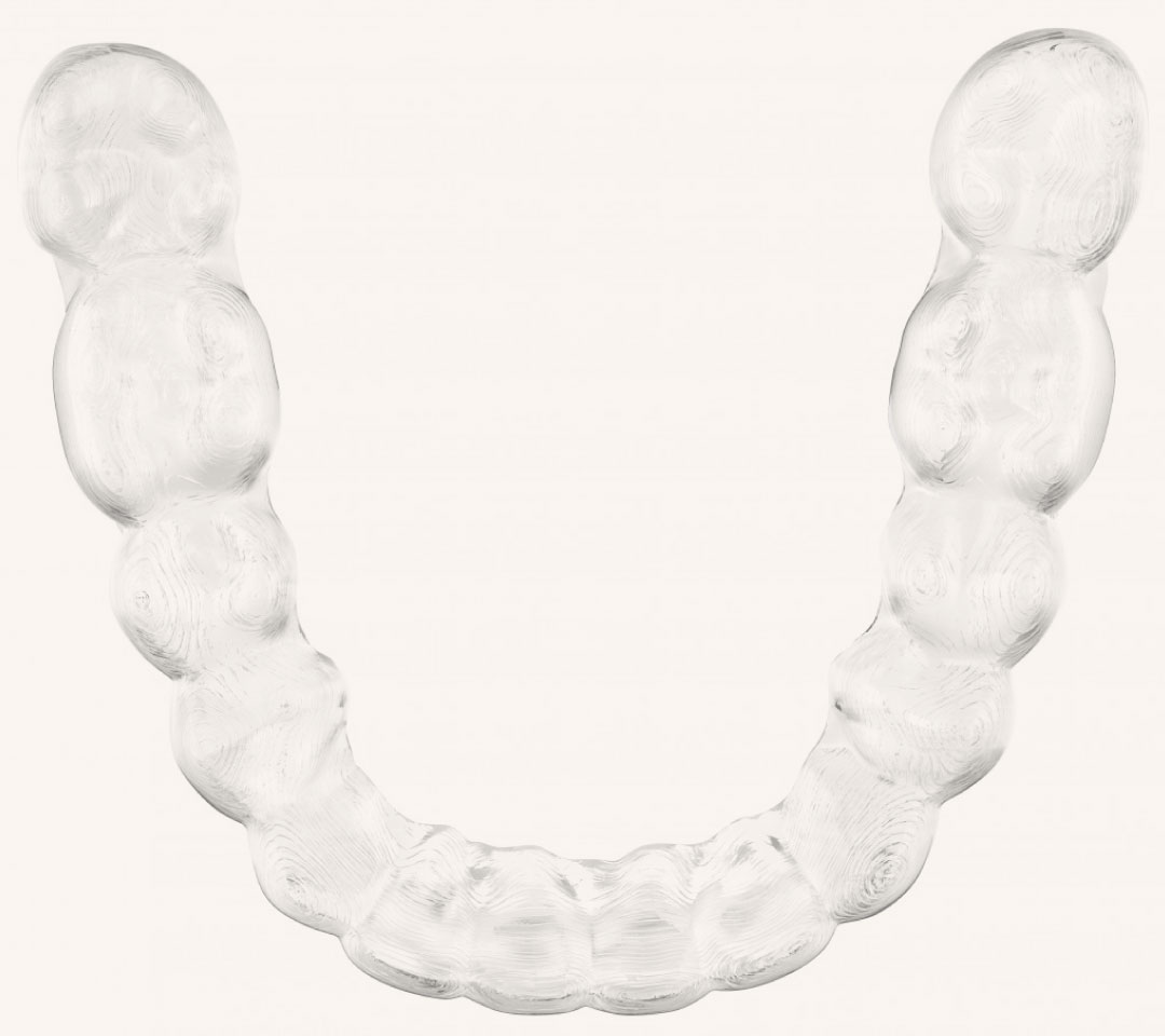 マウスピース型矯正装置