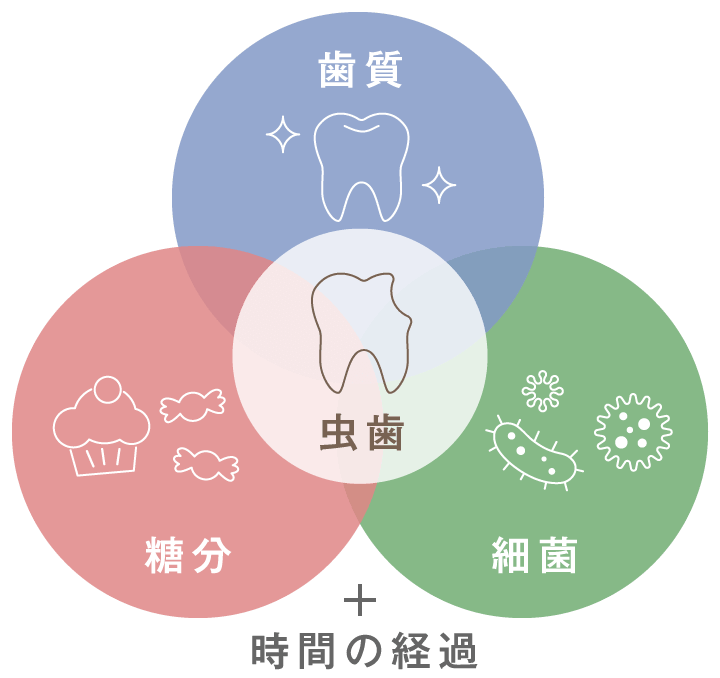 虫歯の原因は「歯質」「糖分」「細菌」と時間の経過