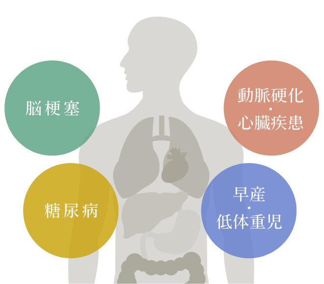 動脈硬化／心臓疾患、早産／低体重児、脳梗塞、糖尿病