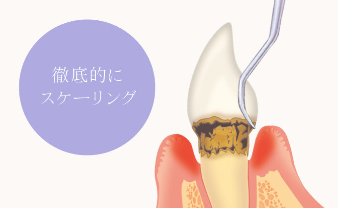徹底的にスケーリング
